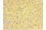 Immunohistochemistry of paraffin-embedded human liver using CSB-PA613493ESR2HU at dilution 1:100