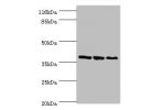 Western blot<br />
All lanes:UDP-glucose 4-epimerase antibody at 2ug/ml<br />
Lane 1:HepG2 cells<br />
Lane 2:Hela cells<br />
Lane 3:A549 cells<br />
Secondary<br />
Goat polyclonal to rabbit at 1/10000 dilution<br />
Predicted band size: 39,31 kDa<br />