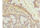 Immunohistochemistry of paraffin-embedded human small intestine tissue using CSB-PA613501ESR1HU at dilution 1:100