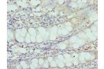 Immunohistochemistry of paraffin-embedded Human rectal tissue using CSB-PA613670DSR1HU at dilution 1:100
