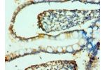 Immunohistochemistry of paraffin-embedded human small intestine using CSB-PA614259ESR2HU at dilution 1:100