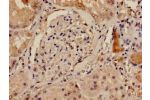 Immunohistochemistry analysis of human kidney tissue using CSB-PA614264LA01HU at dilution of 1:100