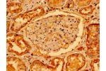 Immunohistochemistry of paraffin-embedded human kidney tissue using CSB-PA614416LA01HU at dilution of 1:100