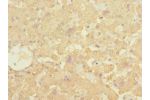 Immunohistochemistry of paraffin-embedded human liver tissue CSB-PA614444ESR1HU at dilution 1:100