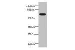 Western blot<br />
All lanes: ALCAMantibody IgG at 5.36ug/ml+ Mouse kidney tissue<br />
Secondary<br />
Goat polyclonal to rabbit IgG at 1/10000 dilution<br />
Predicted band size: 66,64,16,34 kDa<br />
Observed band size: 65 kDa<br />