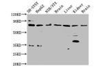 Western Blot<br />
Positive WB detected in:SH-SY5Y whole cell lysate,HepG2 whole cell lysate,NIH/3T3 whole cell lysate,Rat brain tissue,Rat liver tissue,Rat kidney tissue,Mouse brain tissue<br />
All lanes:CUX1 antibody at 3.7