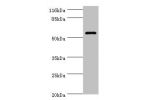 Western blot<br />
All lanes:GK3P antibody at 2ug/ml+Hela whole cell lysate<br />
Secondary<br />
Goat polyclonal to rabbit at 1/10000 dilution<br />
Predicted band size: 61kDa<br />
Observed band size: 61kDa<br />