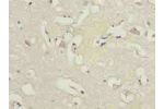 Immunohistochemistry of paraffin-embedded human brain tissue using CSB-PA614878LA01HU at dilution of 1:100