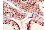 Immunohistochemistry of paraffin-embedded human testis tissue using CSB-PA614974LA01HU at dilution of 1:100