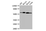 Western Blot<br />
Positive WB detected in:U87 whole cell lysate,Mouse brain tissue,Rat brain tissue,Rat lung tissue<br />
All lanes:DPYSL2 antibody at 4