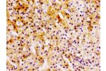 Immunohistochemistry of paraffin-embedded human adrenal gland tissue using CSB-PA614984LA01HU at dilution of 1:100