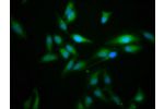 Immunofluorescence staining of Hela cells with CSB-PA615661LA01HU at 1:166,counter-stained with DAPI. The cells were fixed in 4% formaldehyde, permeabilized using 0.2% Triton X-100 and blocked in 10% normal Goat Serum. The cells were then incubated with t