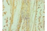 Immunohistochemistry of paraffin-embedded human prostate using CSB-PA615666ESR2HU at dilution 1:100