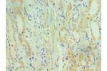 Immunohistochemistry of paraffin-embedded human kidney using CSB-PA615674ESR2HU at dilution 1:100