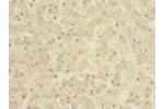 Immunohistochemistry of paraffin-embedded human liver tissue CSB-PA615684ESR2HU at dilution 1:100