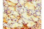 Immunohistochemistry of paraffin-embedded human thyroid using CSB-PA615708ESR1HU at dilution 1:100