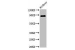 Western Blot<br />
Positive WB detected in:Mouse kidney tissue<br />
All lanes:CDH18 antibody at 2.4