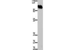 Gel: 8%SDS-PAGE, Lysate: 30 
