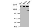 Western Blot<br />
Positive WB detected in:Hela whole cell lysate,HepG2 whole cell lysate,Rat brain tissue<br />
All lanes:CKAP5 antibody at 6