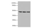 Western blot<br />
All lanes: FAM53B antibody at 2ug/ml<br />
Lane 1 : MCF7 whole cell lysate<br />
Lane 2 : A549 whole cell lysate<br />
Lane 3 : HCT116 whole cell lysate<br />
Secondary<br />
Goat polyclonal to Rabbit IgG at 1/10000 dilution<br />
Predi