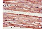 Immunohistochemistry of paraffin-embedded human heart tissue using CSB-PA617906LA01HU at dilution of 1:100
