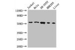 Western Blot<br />
Positive WB detected in:Jurkat whole cell lysate,Hela whole cell lysate,SH-SY5Y whole cell lysate,HEK293 whole cell lysate,Mouse liver tissue<br />
All lanes:FKBP8 antibody at 3ug/ml<br />
Secondary<br />
Goat polyclonal to rabbit IgG a