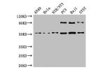 Western Blot<br />
Positive WB detected in:A549 whole cell lysate,Hela whole cell lysate,NIH/3T3 whole cell lysate,PC3 whole cell lysate,Raji whole cell lysate,SH-SY5Y whole cell lysate<br />
All lanes:BECN1 antibody at 4