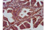 IHC image of CSB-PA617926LA01HU diluted at 1:400 and staining in paraffin-embedded human prostate tissue performed on a Leica BondTM system. After dewaxing and hydration, antigen retrieval was mediated by high pressure in a citrate buffer (pH 6.0). Sectio
