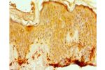 Immunohistochemistry of paraffin-embedded human skin using CSB-PA617995ESR1HU at dilution 1:100