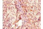 Immunohistochemistry of paraffin-embedded human adrenal gland tissue using CSB-PA617998HA01HU at dilution of 1:100