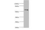 Western blot<br />
All lanes:DHCR24 antibody at 2ug/ml+jurkat whole cell lysate<br />
Secondary<br />
Goat polyclonal to rabbit at 1/10000 dilution<br />
Predicted band size: 61,55 kDa<br />
Observed band size: 60 kDa<br />
