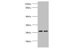 All lanes:Adiponectin antibody at 2ug/ml<br />
Lane 1 : Human NIH3T3 whole cell lysate<br />
Lane 2 : Human HL-60 whole cell lysate<br />
Secondary<br />
Goat polyclonal to rabbit IgG at 1/10000 dilution<br />
Predicted band size: 26kDa<br />
Observed ban