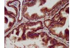 IHC image of CSB-PA618094LA01HU diluted at 1:500 and staining in paraffin-embedded human prostate tissue performed on a Leica BondTM system. After dewaxing and hydration, antigen retrieval was mediated by high pressure in a citrate buffer (pH 6.0). Sectio