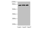 Western blot<br />
All lanes:CPEB4 antibody at 2ug/ml<br />
Lane 1:Hela whole cell lysate<br />
Lane 2:293T whole cell lysate<br />
Lane 3:U87 whole cell lysate<br />
Secondary<br />
Goat polyclonal to rabbit at 1/10000 dilution<br />
Predicted band size: