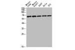 Western blot analysis of mouse-lung mouse-lung lysate, antibody was diluted at 2000. Secondary antibody  was diluted at 1:20000