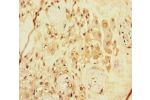 Immunohistochemistry of paraffin-embedded human placenta tissue using CSB-PA618628LA01HU at dilution of 1:100
