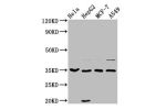 Western Blot<br />
Positive WB detected in:Hela whole cell lysate,HepG2 whole cell lysate,MCF-7 whole cell lysate,A549 whole cell lysate<br />
All lanes:AIMP1 antibody at 3.7