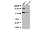 Western Blot<br />
Positive WB detected in:MCF-7 whole cell lysate,HepG2 whole cell lysate<br />
All lanes: FOXC1 antibody at 3ug/ml<br />
Secondary<br />
Goat polyclonal to rabbit IgG at 1/50000 dilution<br />
Predicted band size: 57 kDa<br />
Observed b