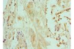 Immunohistochemistry of paraffin-embedded human prostate using CSB-PA618642ESR1HU at dilution 1:100