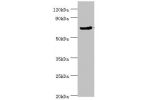 All lanes:Cell division cycle protein 16 homolog antibody at 4ug/ml<br />
Lane 1:Jurkat whole cell lysate<br />
Lane 2:Hela whole cll lysate<br />
Lane 3:k562 whole cell lysate<br />
Secondary<br />
Goat polyclonal to rabbit at 1/10000 dilution<br />
Pred