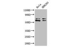 Western Blot<br />
Positive WB detected in:Hela whole cell lysate,HEK293 whole cell lysate<br />
All lanes: COASY antibody at 3.4ug/ml<br />
Secondary<br />
Goat polyclonal to rabbit IgG at 1/50000 dilution<br />
Predicted band size: 63,66 kDa<br />
Obser
