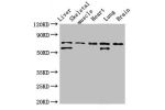 Western Blot<br />
Positive WB detected in:Rat liver tissue,Rat skeletal muscle tissue,Mouse heart tissue,Mouse lung tissue,Mouse brain tissue<br />
All lanes:BIRC2 antibody at 3.5