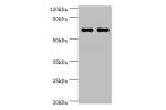 Western blot<br />
All lanes: Baculoviral IAP repeat-containing protein 2 antibody at 5ug/ml<br />
Lane 1:HepG2 whole cell lysate<br />
Lane 2:K562 whole cell lysate<br />
Secondary<br />
Goat polyclonal to rabbit at 1/10000 dilution<br />
Predicted band 