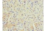 Immunohistochemistry of paraffin-embedded human liver tissue CSB-PA618796ESR1HU at dilution 1:100