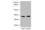 Western blot<br />
All lanes: FHL3 antibody at 1.42ug/ml<br />
Lane 1 : Human placenta tissue<br />
Lane 2 : K562 whole cell lysate<br />
Secondary<br />
Goat polyclonal to rabbit IgG at 1/10000 dilution<br />
Predicted band size: 31 kDa<br />
Observed ba