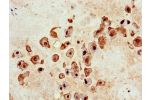 Immunohistochemistry of paraffin-embedded human placenta tissue using CSB-PA618877LA01HU at dilution of 1:100