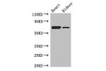 Western Blot<br />
Positive WB detected in:Mouse heart tissue,Mouse kidney tissue<br />
All lanes: ETFDH antibody at 3ug/ml<br />
Secondary<br />
Goat polyclonal to rabbit IgG at 1/50000 dilution<br />
Predicted band size: 69,63 kDa<br />
Observed band si