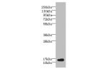 Western blot<br />
All lanes: BATF antibody at 6ug/ml+ NIH/3T3 whole cell lysate<br />
Goat polyclonal to rabbit at 1/10000 dilution<br />
Predicted band size: 14 kDa<br />
Observed band size: 14 kDa<br />