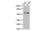 Western Blot<br />
Positive WB detected in:K562 whole cell lysate,HepG2 whole cell lysate<br />
All lanes:FSCN1 antibody at 3.2