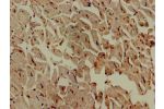 Immunohistochemistry of paraffin-embedded human heart tissue using CSB-PA619774LA01HU at dilution of 1:100